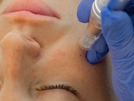Tratamiento facial regenerativo con exosomas y PDRN en BOSA